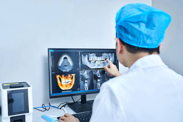 Best Emergency Wisdom Teeth Removal in Jacksonville Beach, FL
